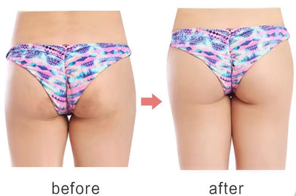Buttock Hip UP Cream Fast Bigger Butt Plump Shape Ass Enhance Enlargement